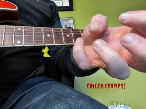 Finger Cramps in String Instrument Players